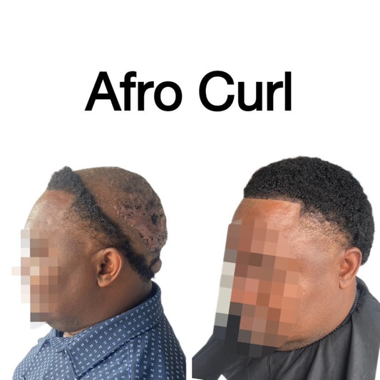 Afro Curl Hair Replacement System