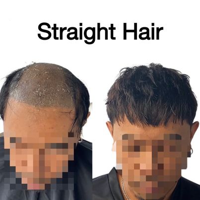 Straight Hair System